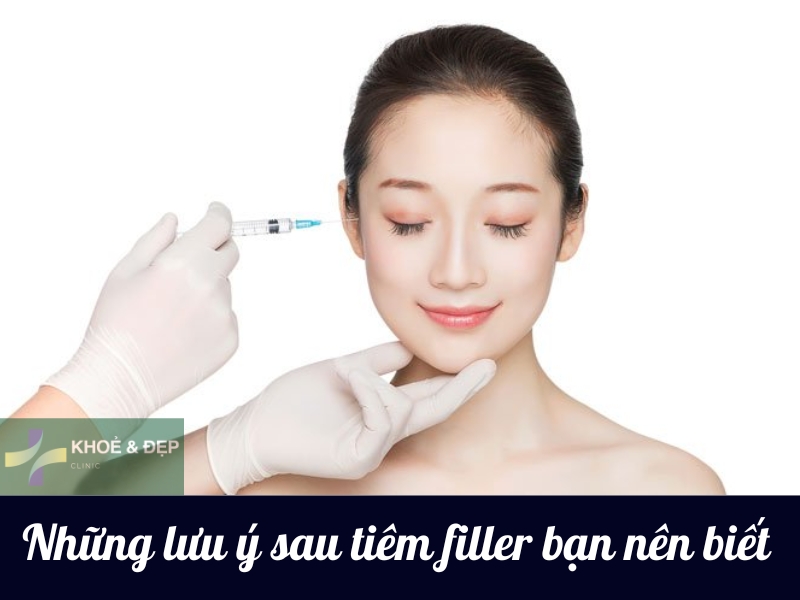 Một số điều cần lưu ý khi tiêm filler mũi