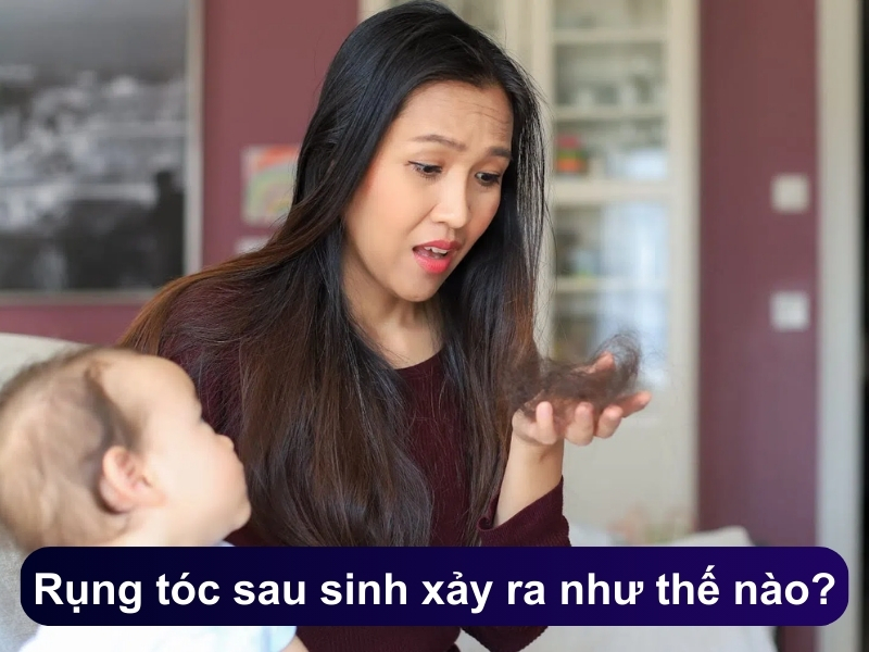 Rụng tóc sau sinh xảy ra như thế nào?
