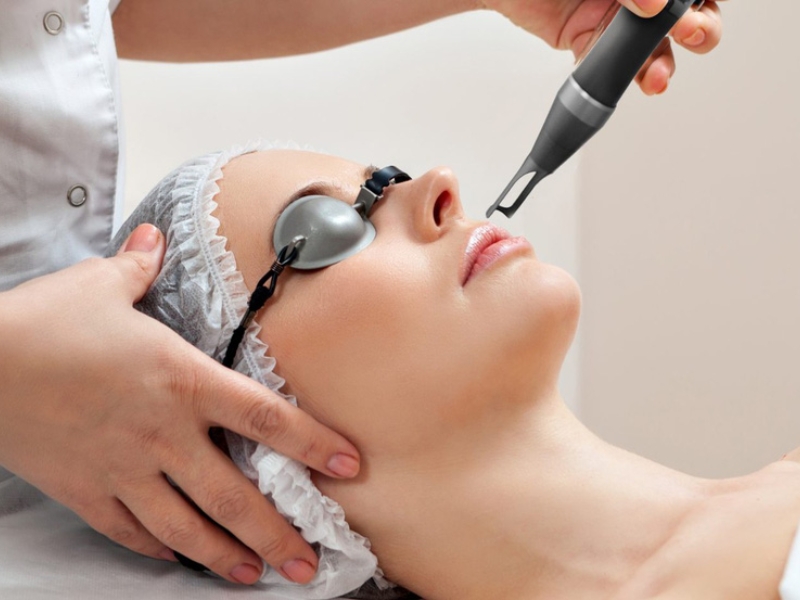 Tái tạo da mặt bằng tia laser