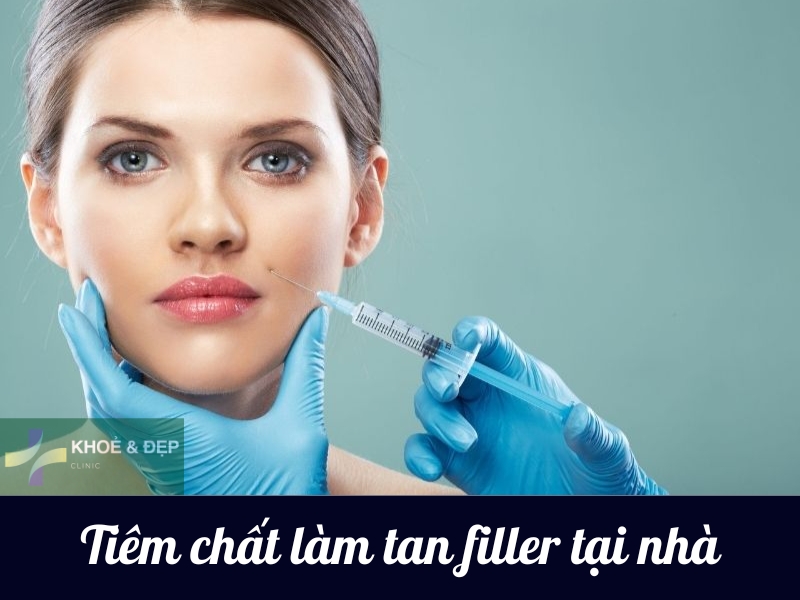 Tiêm chất làm tan filler