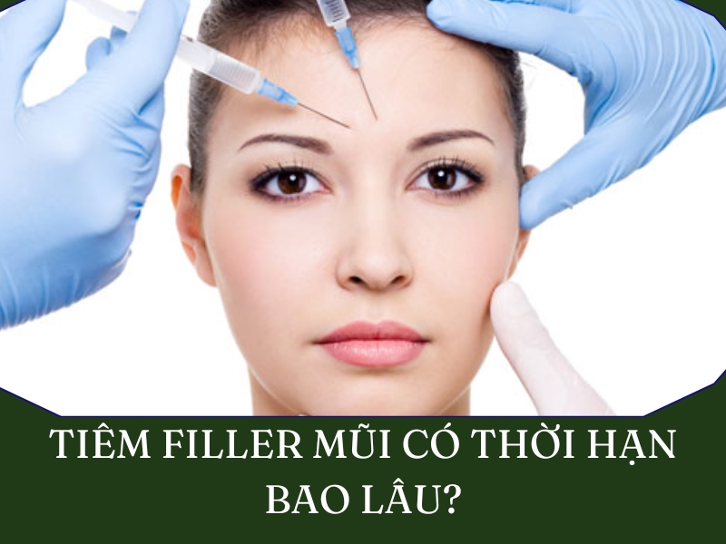Tiêm filler mũi giữ được bao lâu?