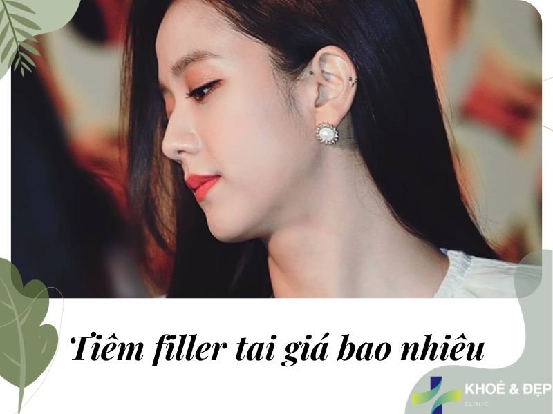 Tiêm filler tai giá bao nhiêu?