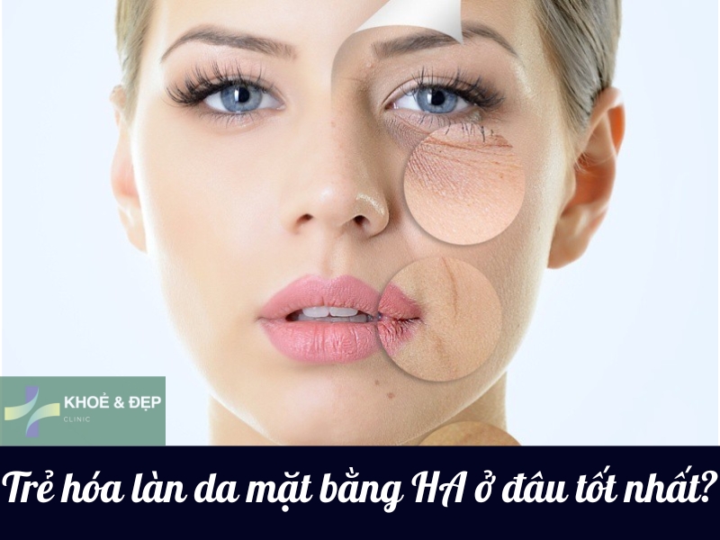 Trẻ hóa làn da mặt bằng HA ở đâu tốt nhất?