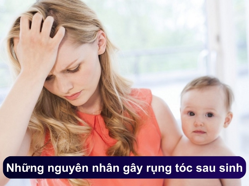 Những nguyên nhân gây rụng tóc sau sinh