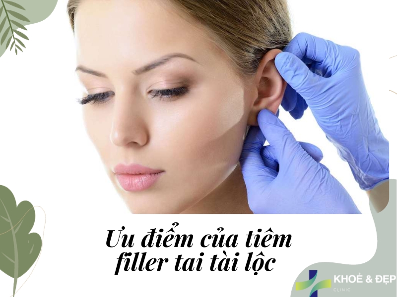 Ưu điểm của tiêm tai tài lộc là gì?