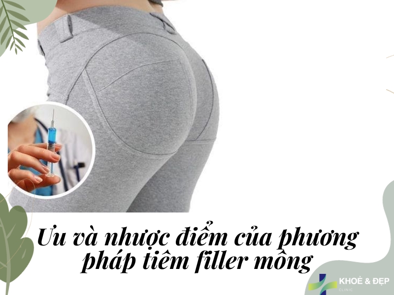 Ưu và nhược điểm của phương pháp tiêm filler mông
