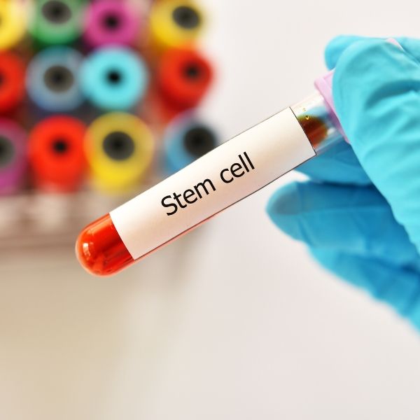 Liệu pháp tế bào gốc trong điều trị chính là đưa vào cơ thể các tế bào non trẻ để có thể tạo ra các loại tế bào mới