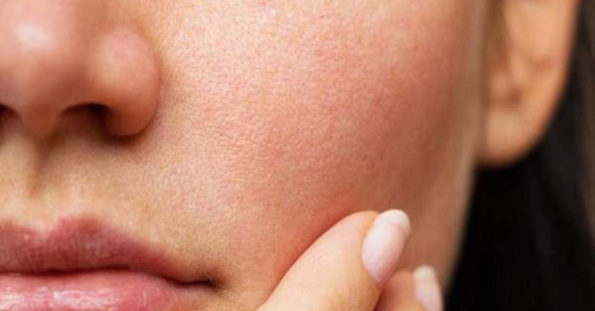 Cải thiện làn da sần sùi, thô ráp