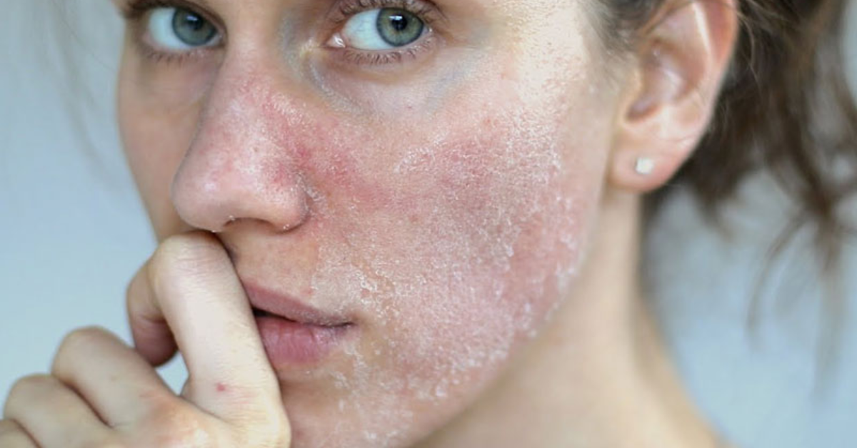 Kem chống nắng Skin Aqua màu hồng phù hợp cho da khô