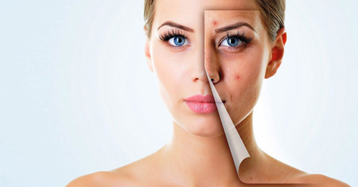 Hỗ trợ làm mờ sẹo và các vết thâm sạm