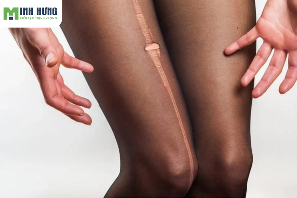 top6-tuyet-chieu-giu-quan-tat-khong-bi-xuoc-nang-nao-cung-nen-biet