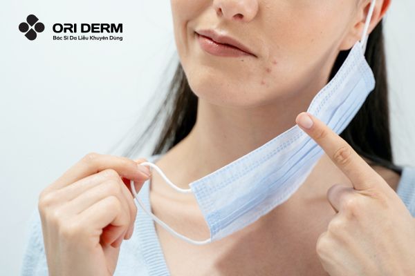 Những dấu hiệu da bị ảnh bởi đeo khẩu trang