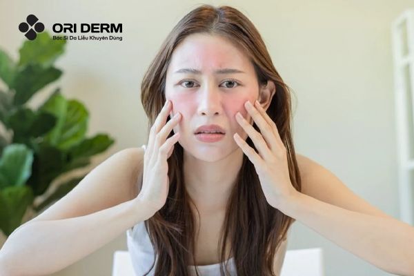 Dấu hiệu nhận biết dị ứng mỹ phẩm trên mặt