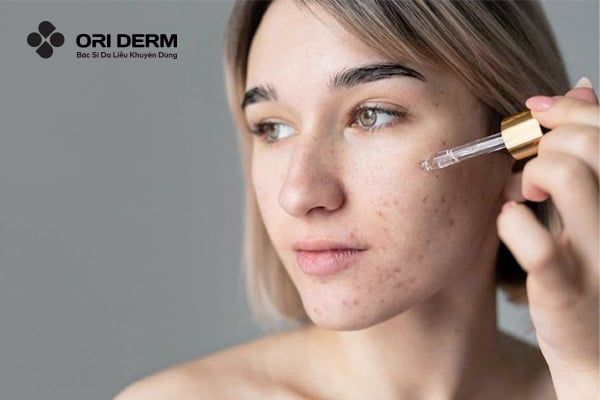 Công dụng của serum đối với da dầu mụn