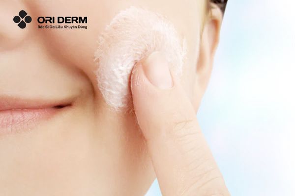 Da dầu mụn có nên dùng kem dưỡng ẩm không?