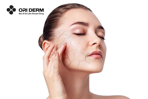 Vì sao da khô cần sử dụng serum cấp ẩm?