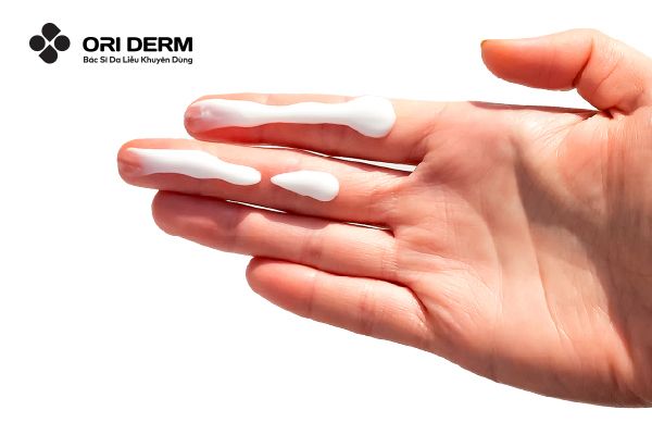 Những lưu ý khác sau khi lăn kim ngoài chế độ ăn uống