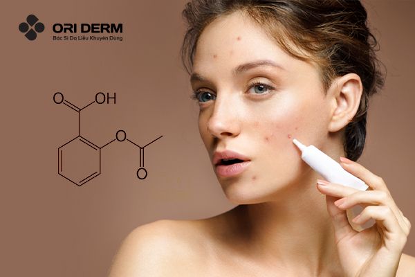 Trị mụn mủ bằng Acid Salicylic