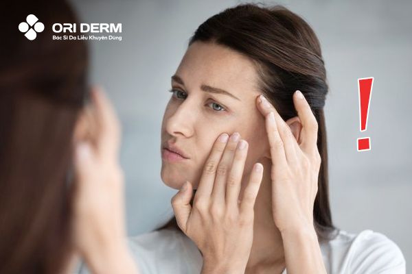 Cách để ngăn ngừa sẹo rỗ đáy tròn trên da