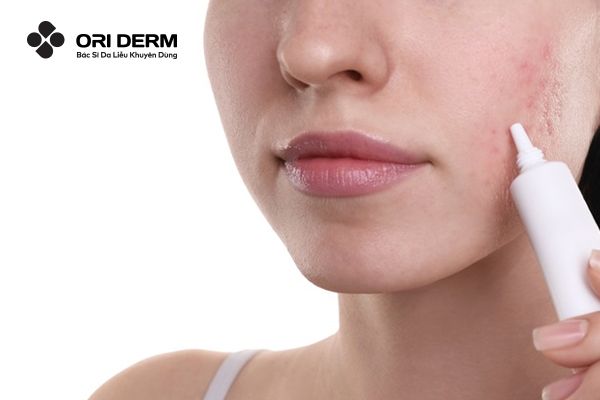 Bổ sung các loại kem trị sẹo