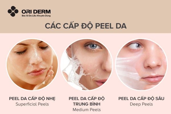 Các cấp độ peel da trị thâm