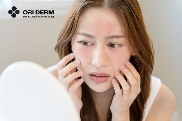 Đặc điểm của làn da nhạy cảm