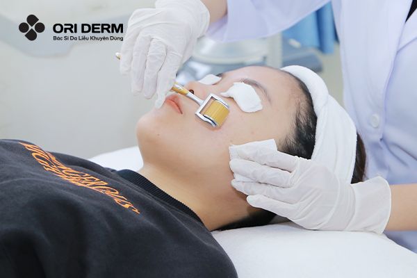 Tác động của thực phẩm đến quá trình phục hồi da sau lăn kim