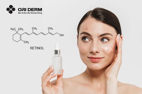 Retinol Có Trị Mụn Không? Cách Dùng Retinol Trị Mụn An Toàn