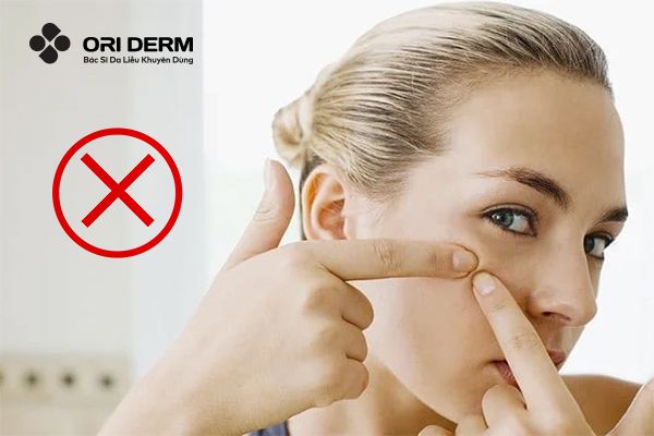 Những lưu ý khi bôi kem trị mụn sau khi đắp mặt nạ