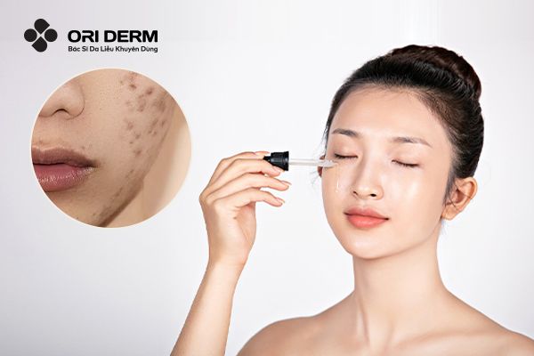 10 Serum Trị Thâm Mụn Cho Da Sáng Đều Màu Và Rạng Rỡ