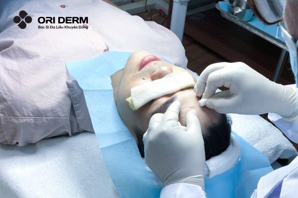 Vì sao cần chăm sóc da sau cắt đáy sẹo