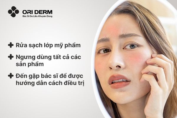 Cách chữa dị ứng mỹ phẩm trên mặt khi thấy da bị dị ứng mỹ phẩm