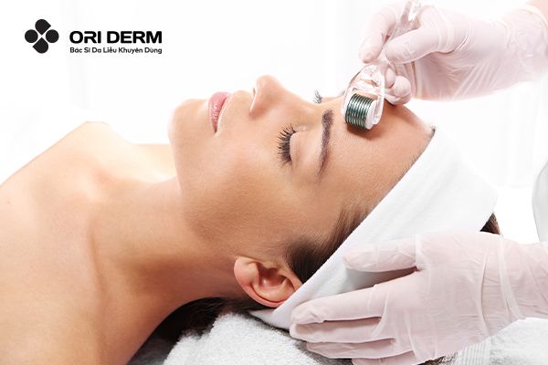 Lăn kim vi điểm trị sẹo mụn