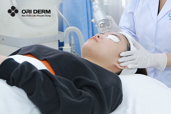 Laser trị sẹo đáy tròn