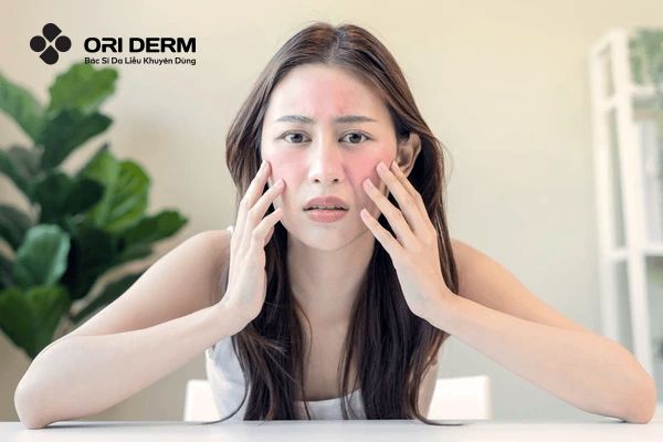 Nguyên nhân khiến mặt bị break out