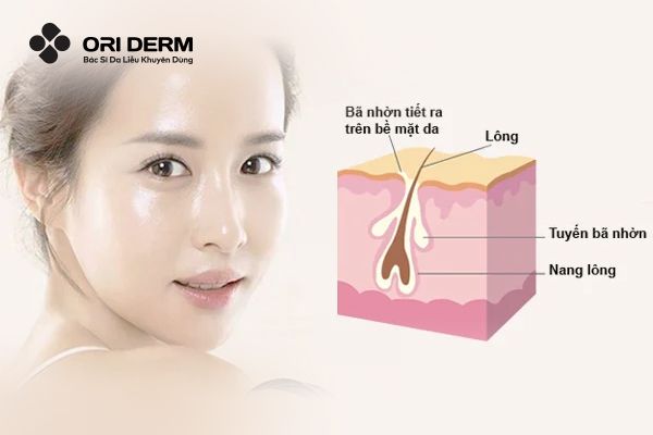 Nguyên nhân gây sợi bã nhờn trên da