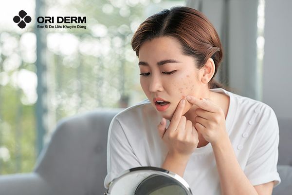 Nguyên nhân gây sẹo rỗ đáy tròn