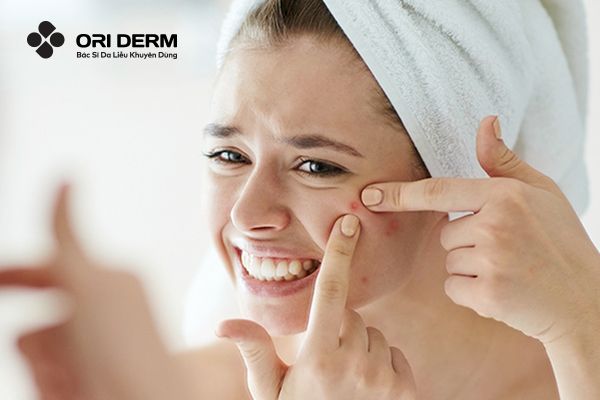 Mụn viêm bị chai nguyên nhân do đâu?