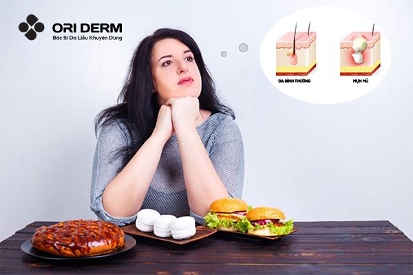 Những nguyên nhân gây mụn mủ trắng