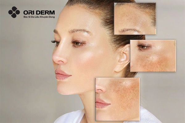 Ai nên dùng Glycolic acid trong quy trình chăm sóc da?