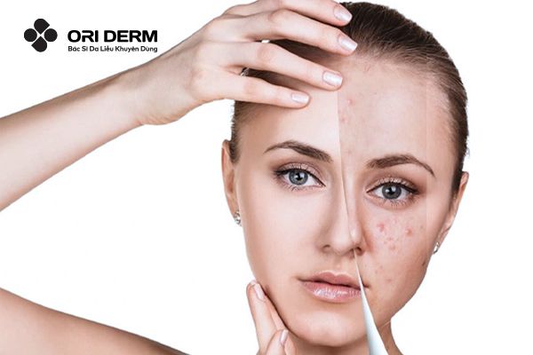 Ảnh hưởng của thức khuya đến làn da