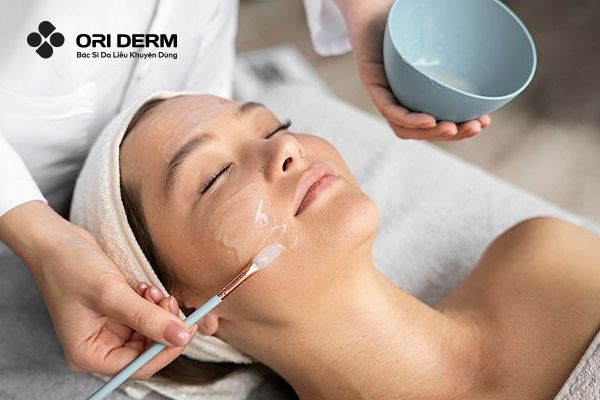 Peel da cải thiện sẹo rỗ đáy tròn