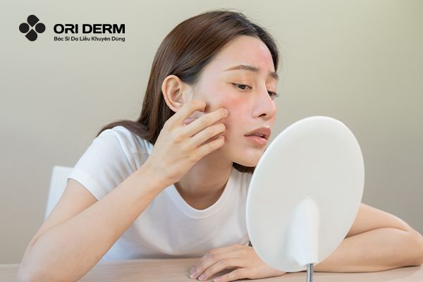 Hướng Dẫn Cách Chữa Dị Ứng Mỹ Phẩm Trên Mặt An Toàn