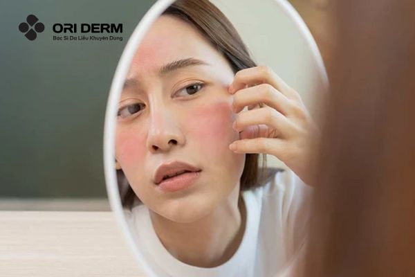 Tác dụng phụ thường gặp khi dùng retinol