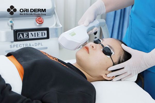 Trị mụn chai viêm bằng công nghệ cao