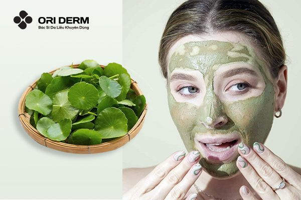 Hướng Dẫn Cách Đắp Mặt Nạ Rau Má Trị Mụn Hiệu Quả Tại Nhà