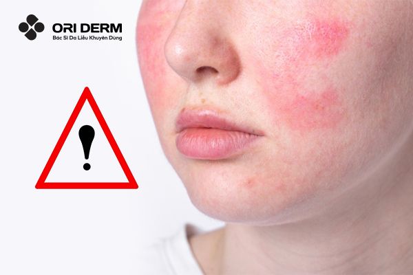 Các vấn đề cần lưu ý khi peel da sinh học