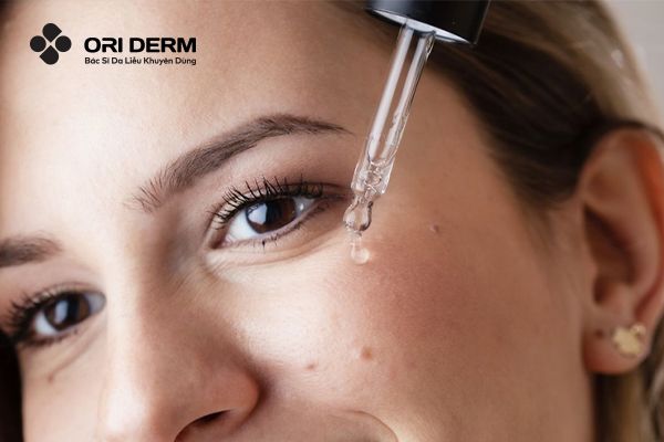 Vậy retinol có trị mụn không?