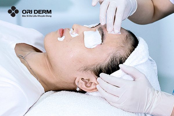 Quy trình peel da trị thâm chuẩn Y khoa