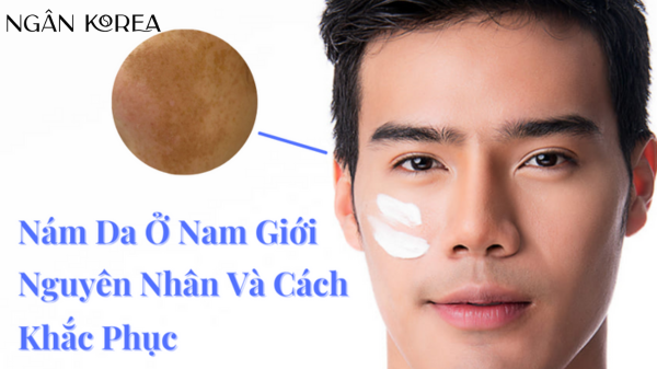 Nám da ở nam giới